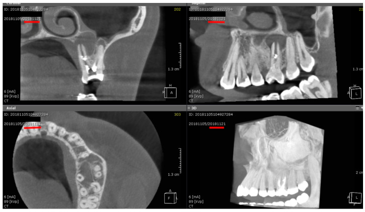 Figure 2