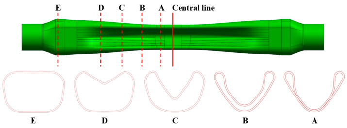 Figure 12