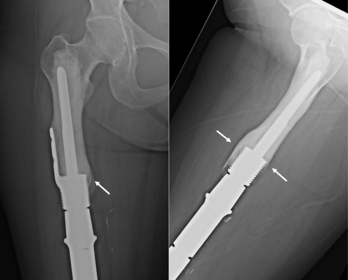 Figure 9
