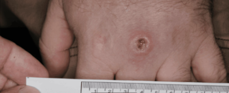 Figure 5
