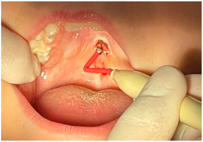 Figure 4