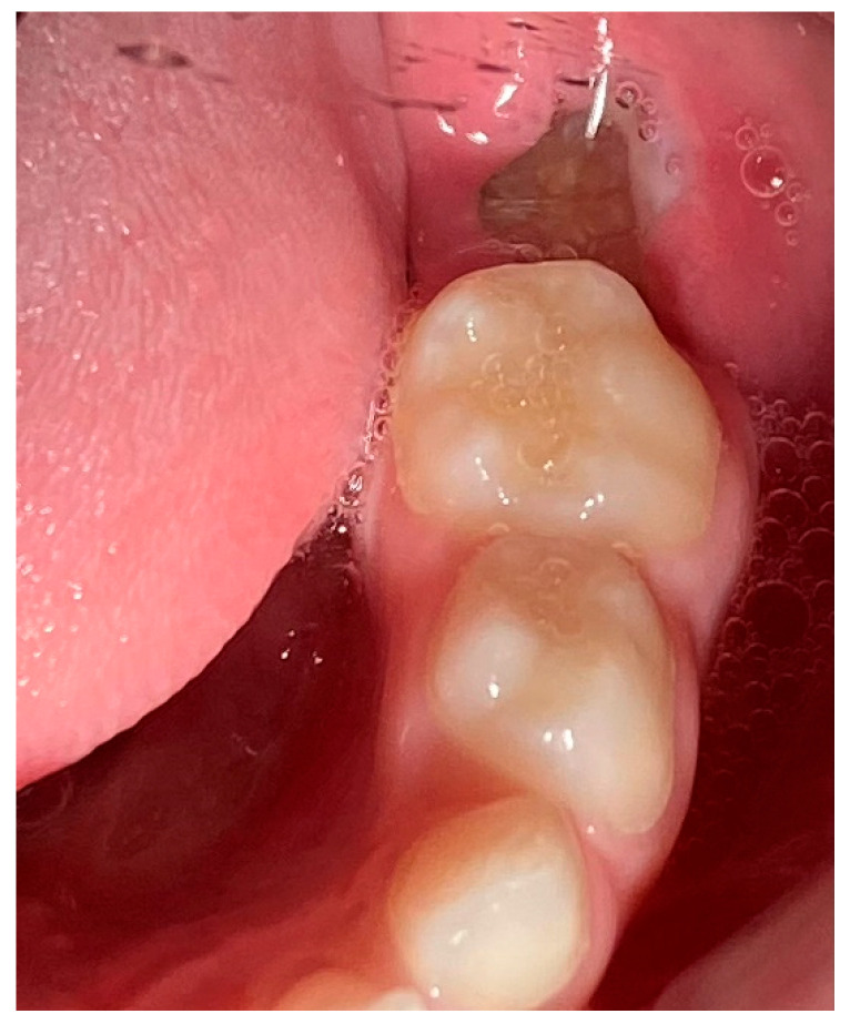 Figure 7