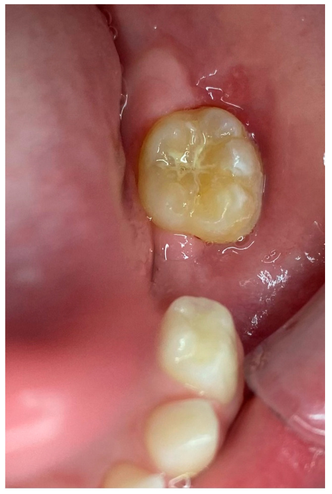 Figure 11