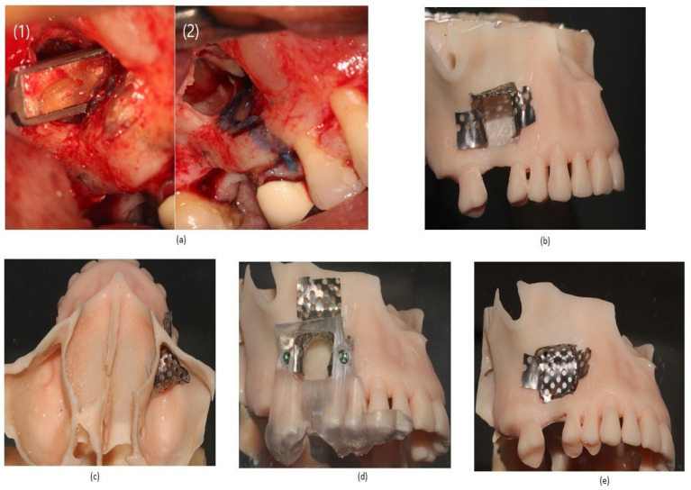 Figure 2
