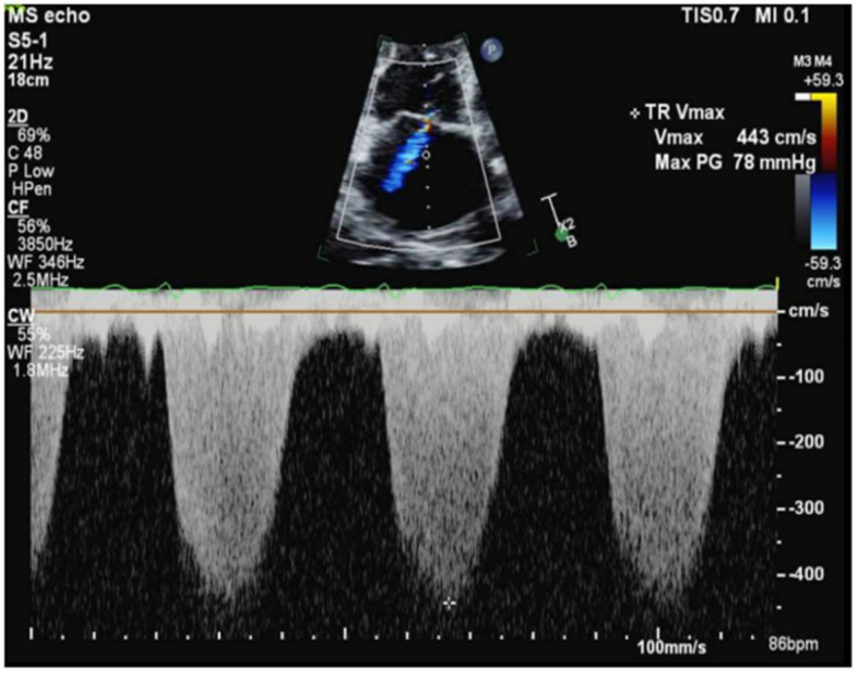 Figure 4