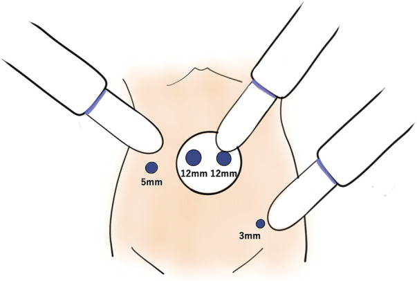 Fig. 3