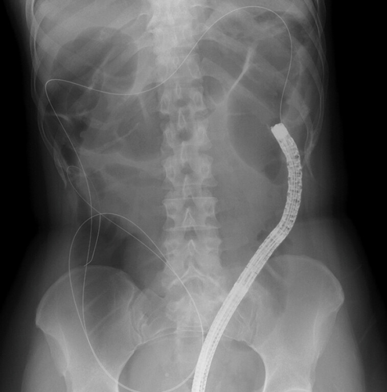 Fig. 2