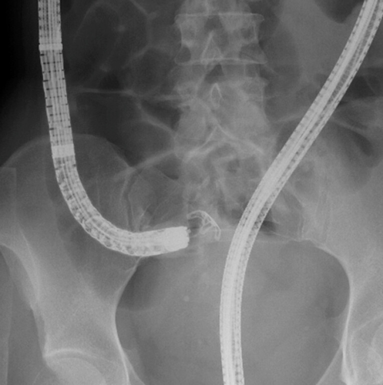 Fig. 4