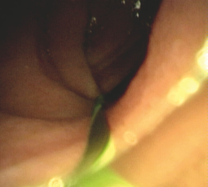 Fig. 2
