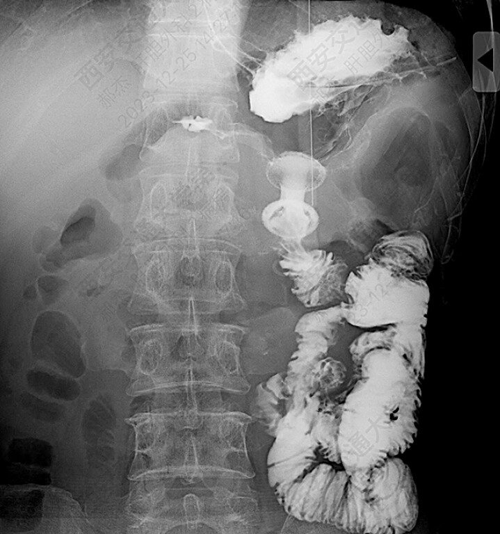 Fig. 5