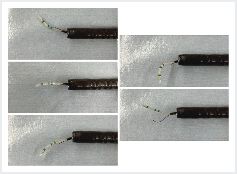 Fig. 1
