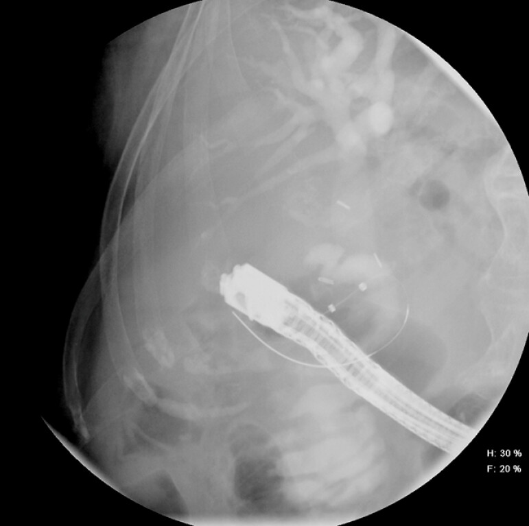 Fig. 4