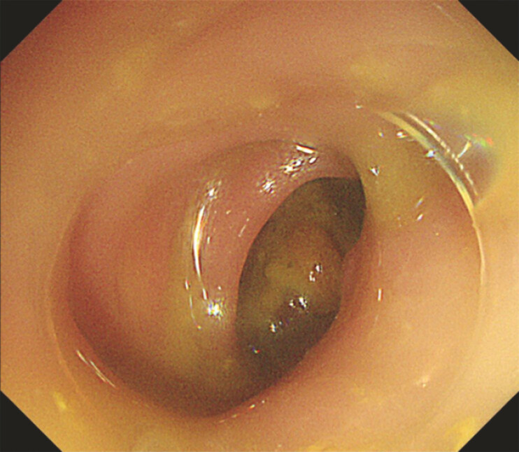 Fig. 4