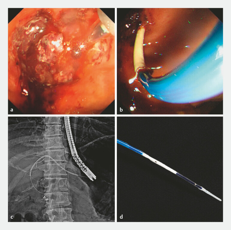 Fig. 4