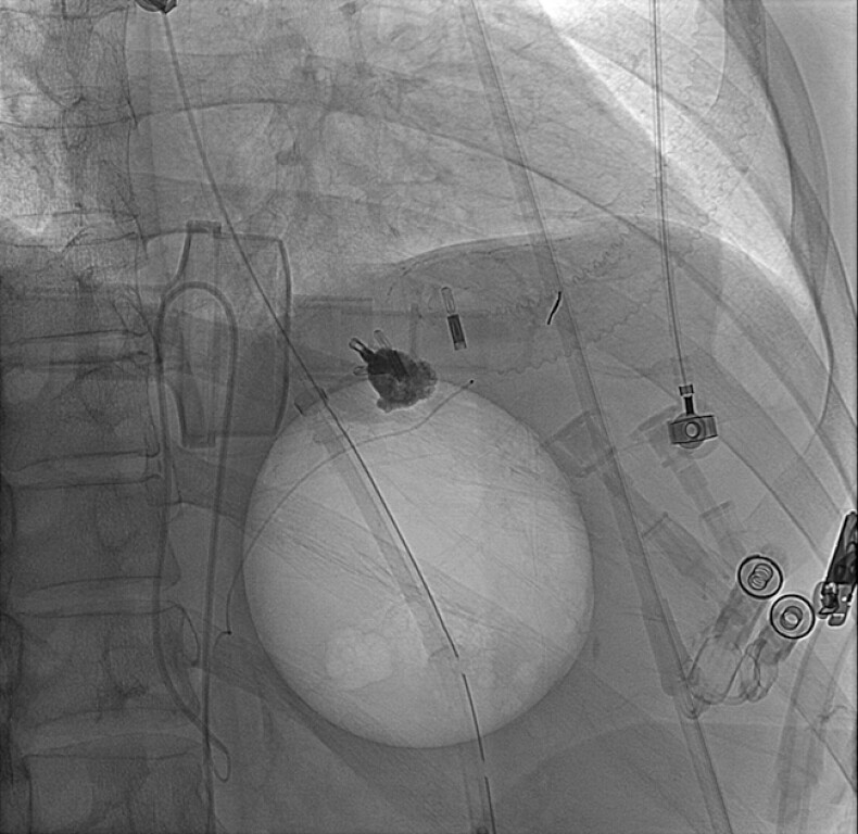 Fig. 4