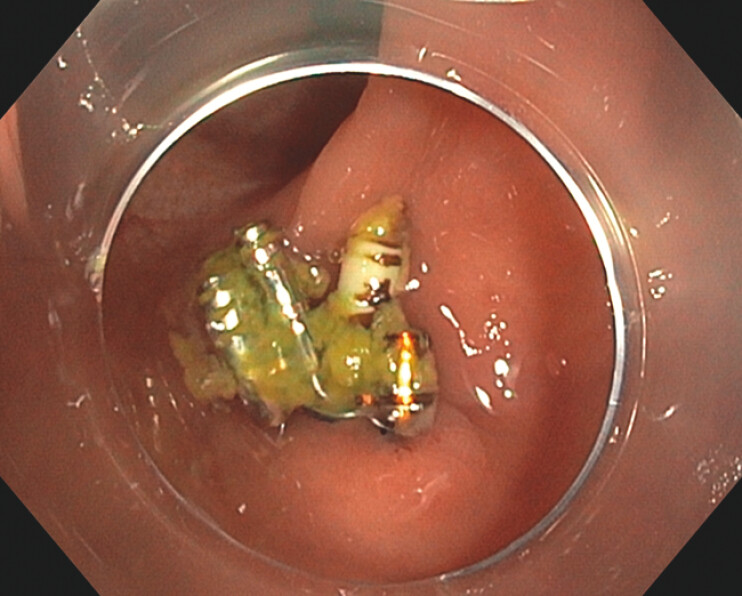 Fig. 2