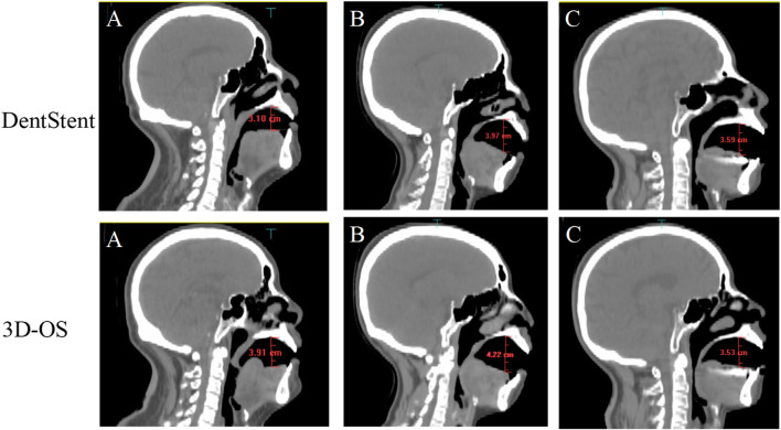 FIGURE 3