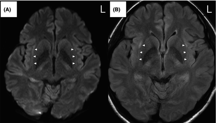 FIGURE 1