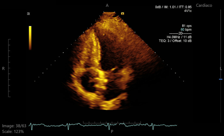 Figure 6