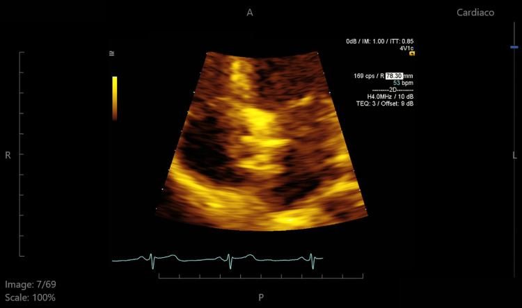 Figure 7