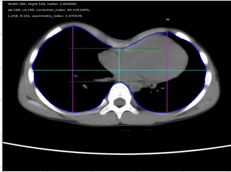 Figure 5