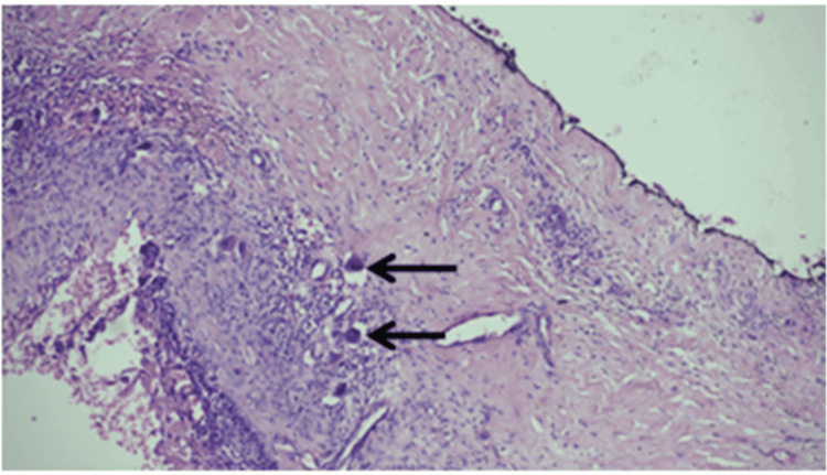 Figure 10