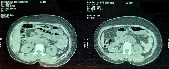 Figure 15