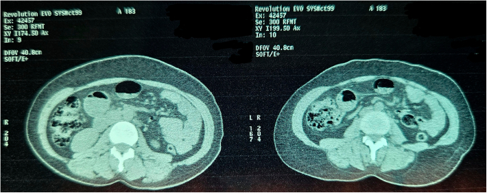Figure 16