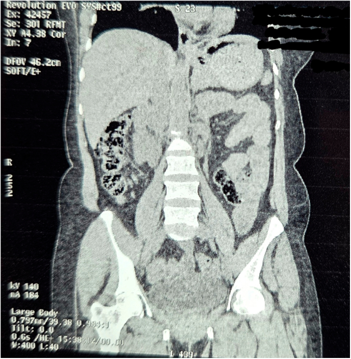 Figure 18