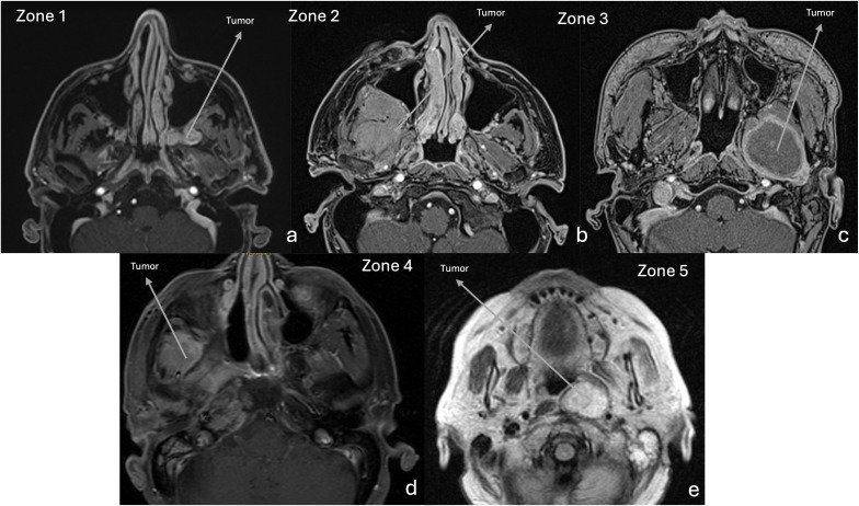 Figure 3