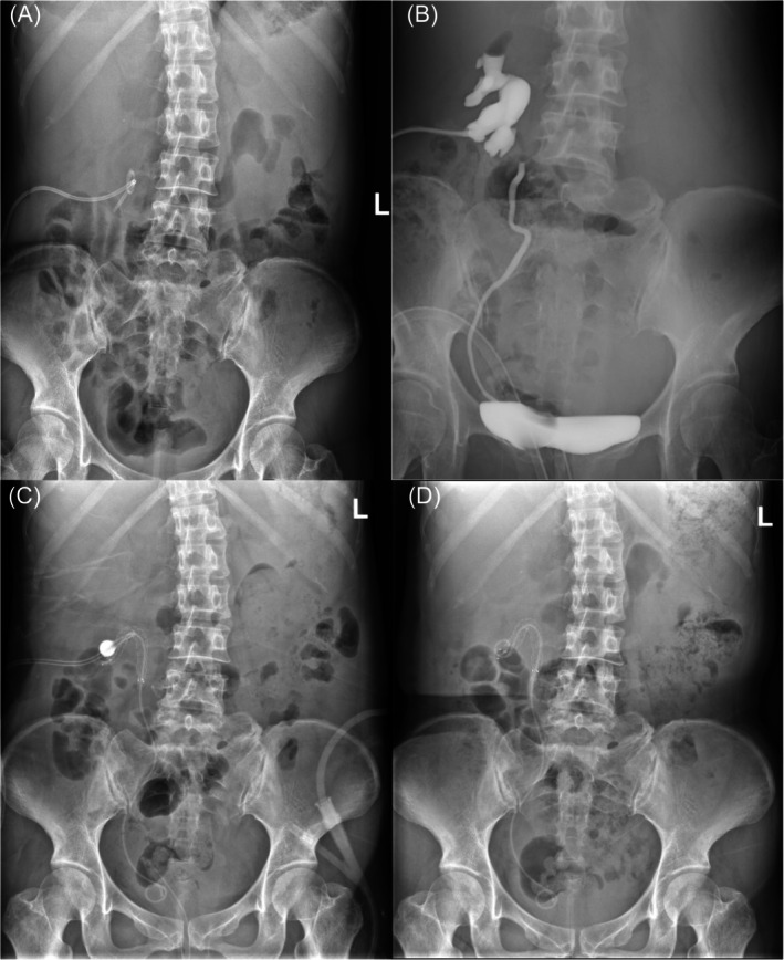 FIGURE 1