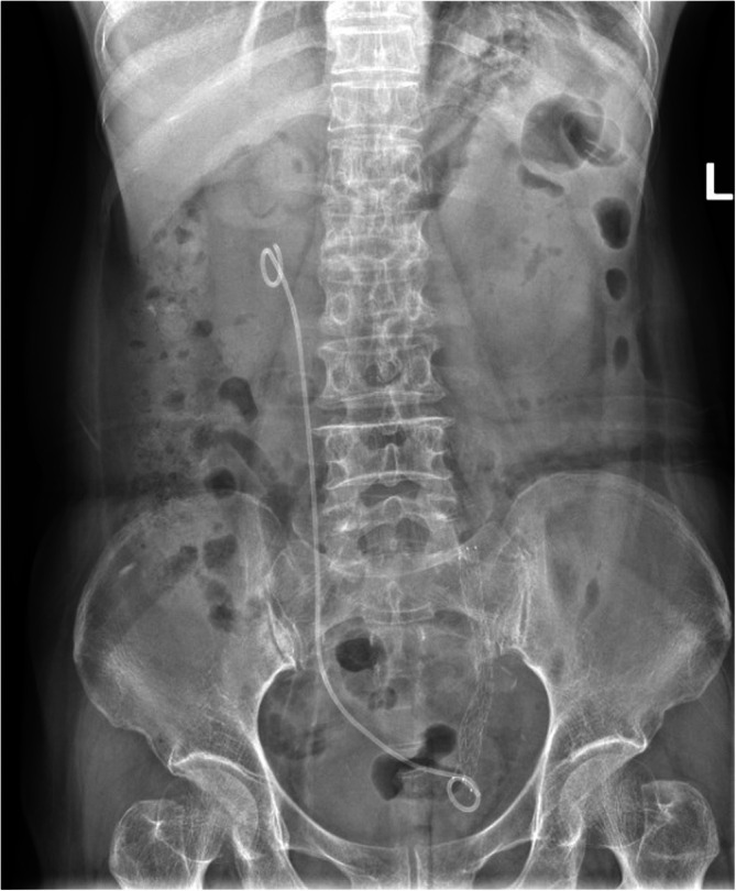 FIGURE 2