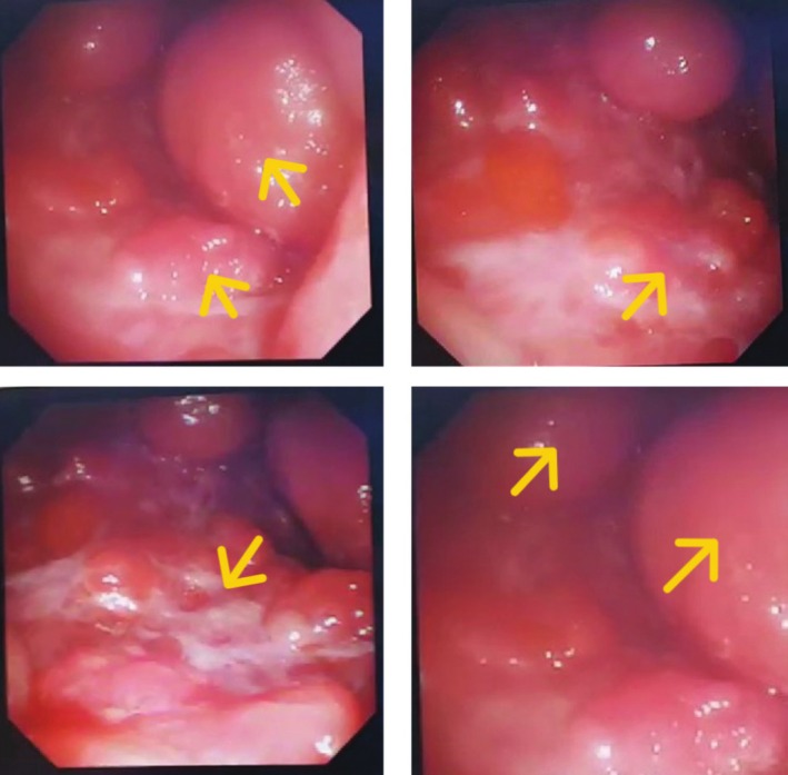 FIGURE 2