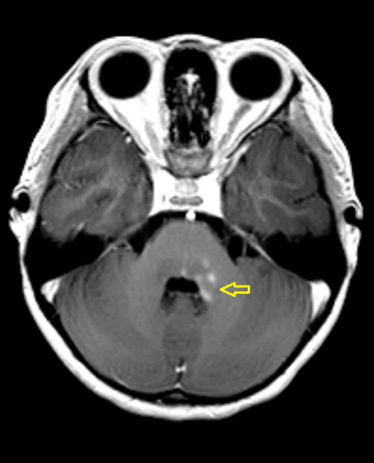 Figure 9