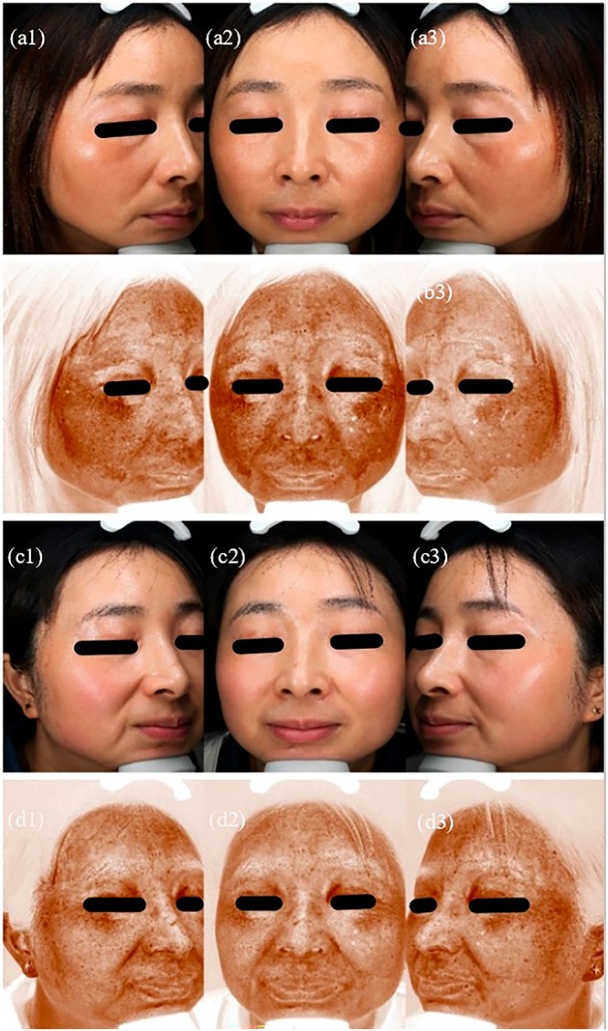 FIGURE 2