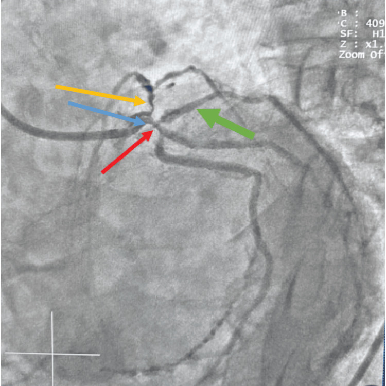 Figure 5