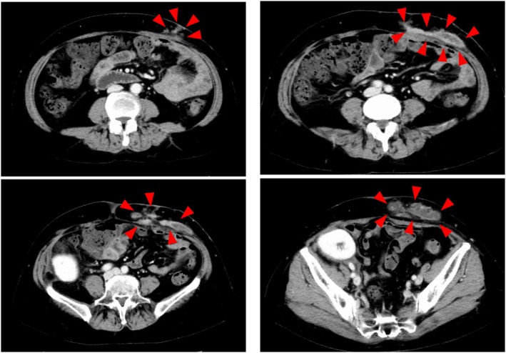 FIGURE 2
