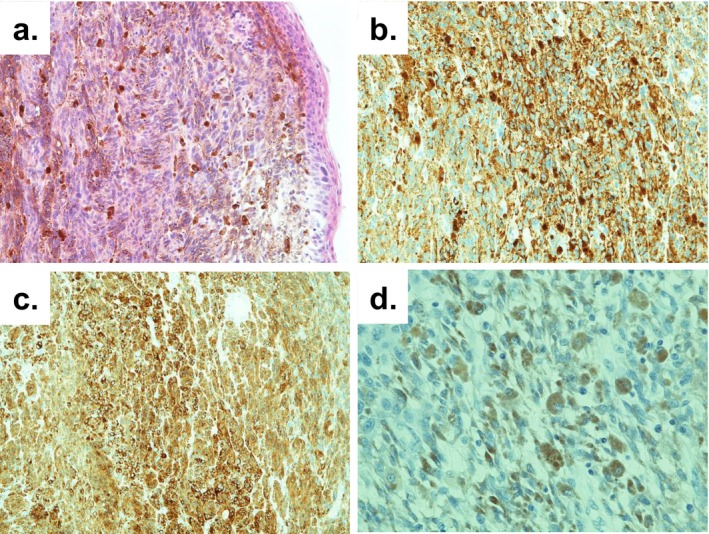 FIGURE 3