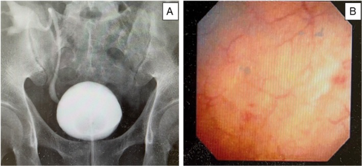 FIGURE 1