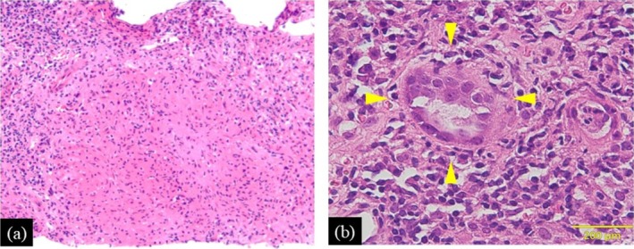 FIGURE 3