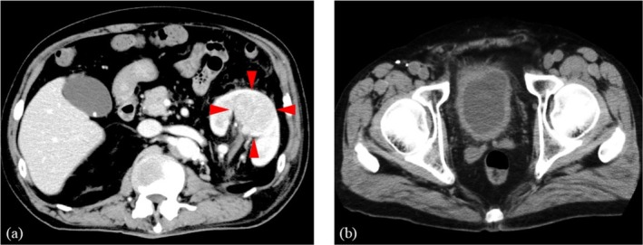 FIGURE 1