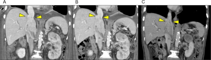 FIGURE 3
