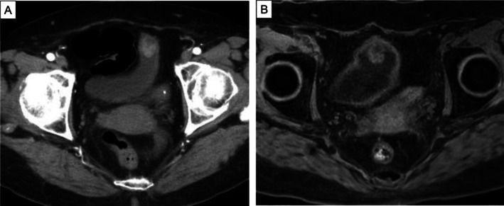 FIGURE 1