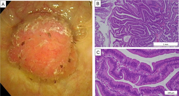 FIGURE 2