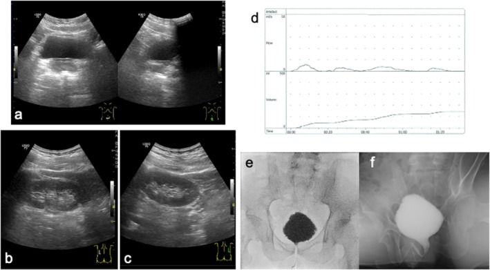 FIGURE 2