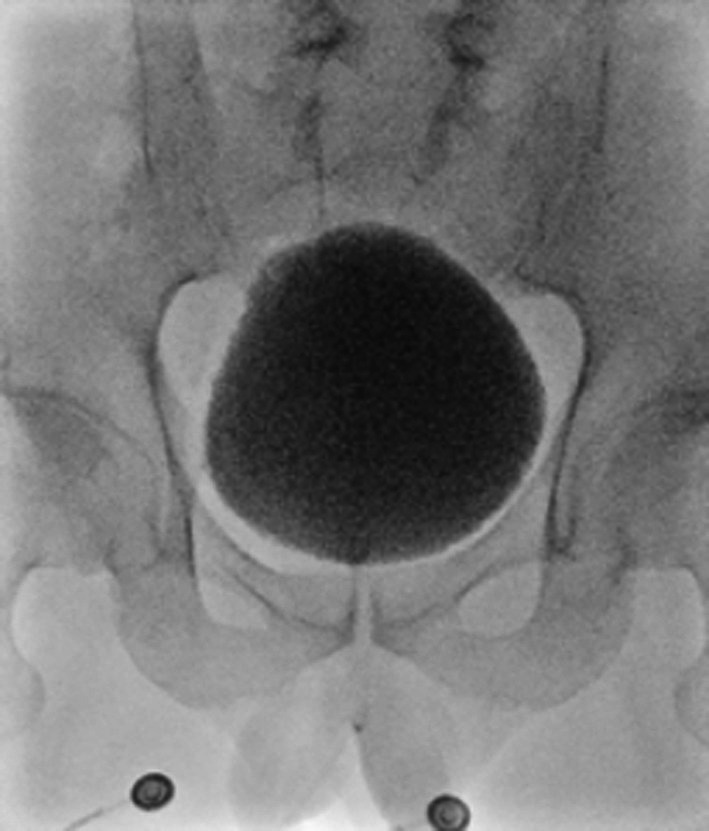 FIGURE 4