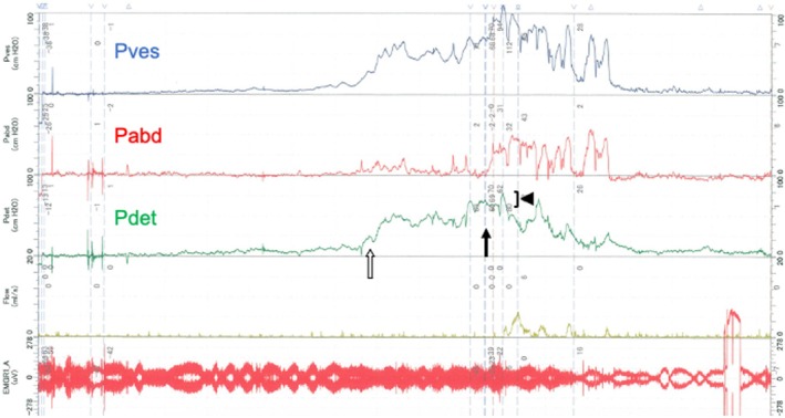 FIGURE 3