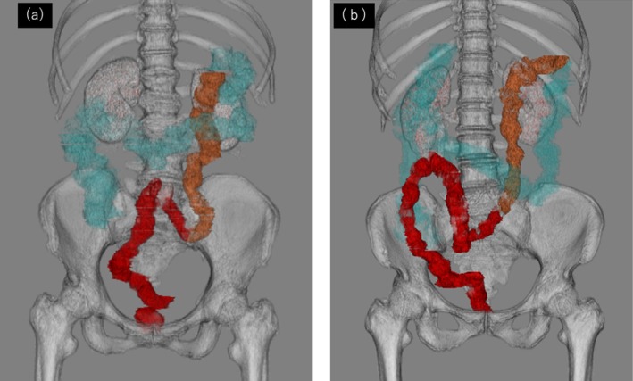 FIGURE 3