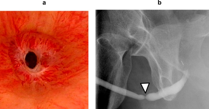 FIGURE 1