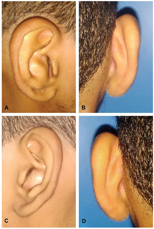 Fig. 4